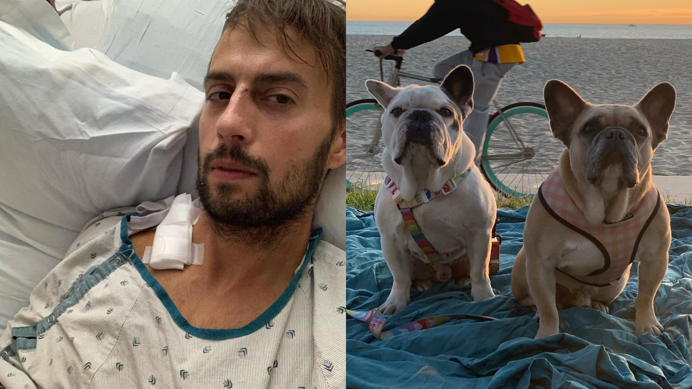 Ryan Fischer, passeador de cães da Lady Gaga, compartilha depoimento com detalhes de como tudo aconteceu